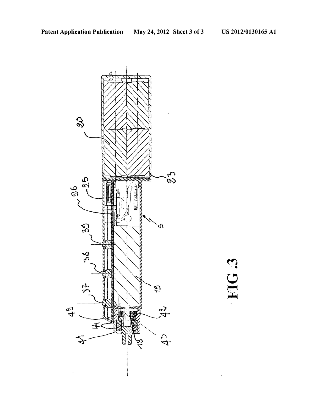 DEVICE FOR ENDOSCOPIC RESECTION OR REMOVAL OF TISSUE - diagram, schematic, and image 04