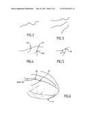 DEVICE AND METHOD FOR SUPERIMPOSING PATTERNS ON IMAGES IN REAL TIME,     PARTICULARLY FOR GUIDANCE BY LOCATION diagram and image