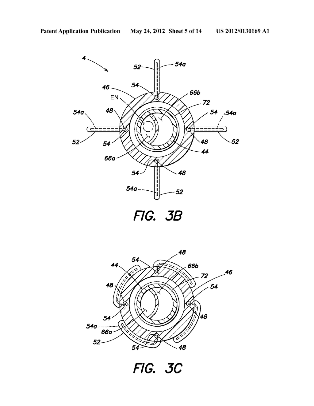 METHOD AND APPARATUS FOR PERFORMING TRANSESOPHAGEAL CARDIOVASCULAR     PROCEDURES - diagram, schematic, and image 06