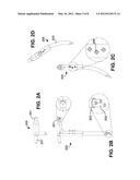 Rapid Endoscopic Gastrointestinal Irrigation System for Gastrointestinal     Bleeding diagram and image