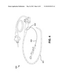 Rapid Endoscopic Gastrointestinal Irrigation System for Gastrointestinal     Bleeding diagram and image