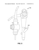 Rapid Endoscopic Gastrointestinal Irrigation System for Gastrointestinal     Bleeding diagram and image