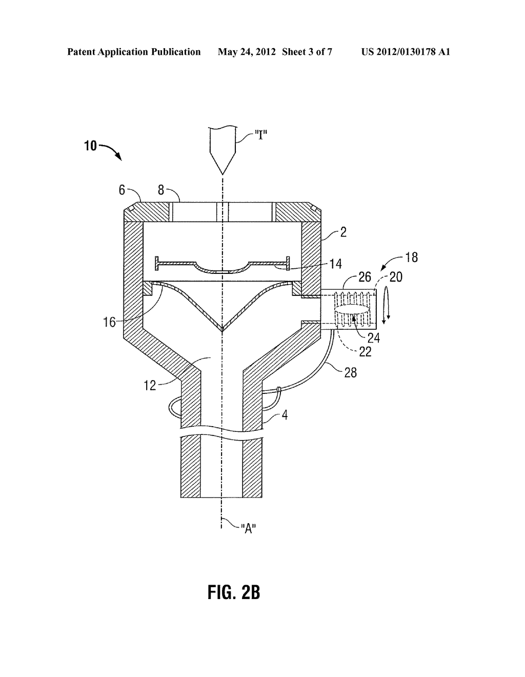 ACCESS APPARATUS INCLUDING DESUFFLATION CONTROL MECHANISM - diagram, schematic, and image 04