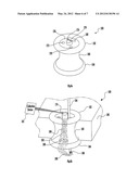 ACCESS ASSEMBLY INCLUDING ONE OR MORE COMPRESSIBLE VENTS diagram and image