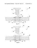 EXPANDABLE ACCESS ASSEMBLY INCLUDING AN INTERNAL THREAD MECHANISM diagram and image