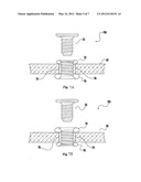 EXPANDABLE ACCESS ASSEMBLY INCLUDING AN INTERNAL THREAD MECHANISM diagram and image