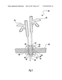 EXPANDABLE ACCESS ASSEMBLY INCLUDING AN INTERNAL THREAD MECHANISM diagram and image