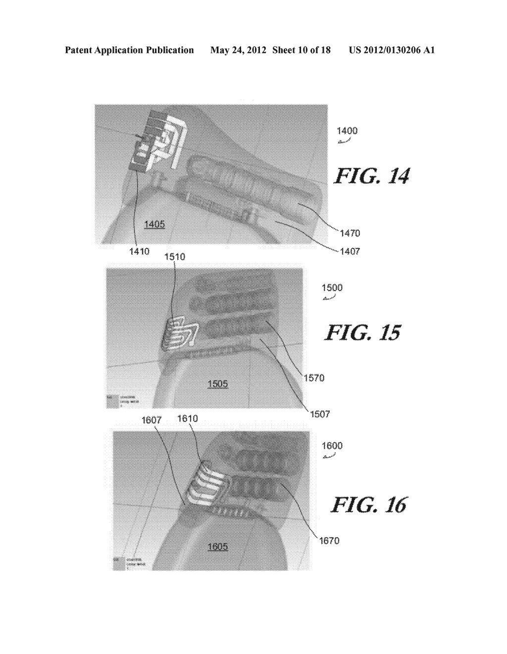 MODULAR ANTENNA FOR IMPLANTABLE MEDICAL DEVICE - diagram, schematic, and image 11