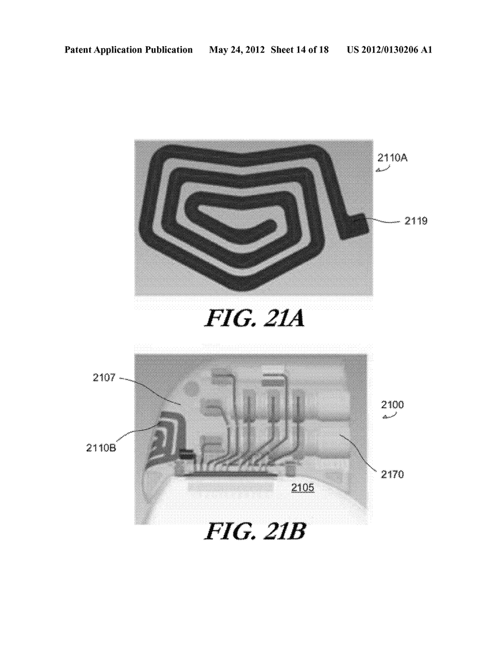 MODULAR ANTENNA FOR IMPLANTABLE MEDICAL DEVICE - diagram, schematic, and image 15