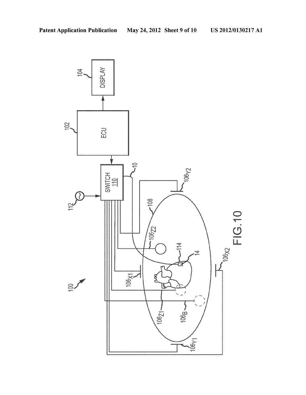 MEDICAL DEVICES HAVING ELECTRODES MOUNTED THEREON AND METHODS OF     MANUFACTURING THEREFOR - diagram, schematic, and image 10