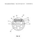 IMPLANTABLE MICRO-ELECTROMECHANICAL SYSTEM SENSOR diagram and image