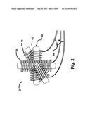 Medical Device Location Systems, Devices and Methods diagram and image