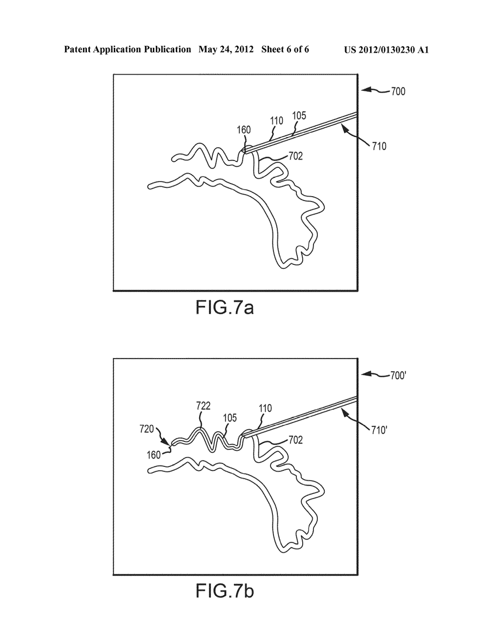 Systems and methods for navigating a surgical device - diagram, schematic, and image 07