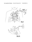 Illustrating a Three-Dimensional Nature of a Data Set on a Two-Dimensional     Display diagram and image