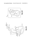 Illustrating a Three-Dimensional Nature of a Data Set on a Two-Dimensional     Display diagram and image