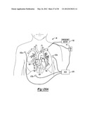 Illustrating a Three-Dimensional Nature of a Data Set on a Two-Dimensional     Display diagram and image