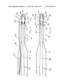 ULTRASOUND CATHETER HAVING PROTECTIVE FEATURE AGAINST BREAKAGE diagram and image