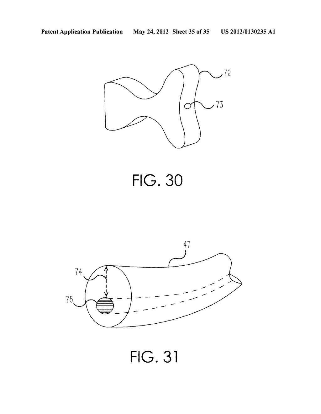 RETROGRADE ENTRY ANTEGRADE PLACEMENT FOR FEMORAL ARTERY ACCESS - diagram, schematic, and image 36