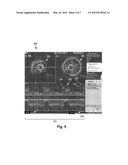 SYSTEMS AND METHODS FOR CONCURRENTLY DISPLAYING A PLURALITY OF IMAGES     USING AN INTRAVASCULAR ULTRASOUND IMAGING SYSTEM diagram and image