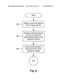 SYSTEMS AND METHODS FOR CONCURRENTLY DISPLAYING A PLURALITY OF IMAGES     USING AN INTRAVASCULAR ULTRASOUND IMAGING SYSTEM diagram and image