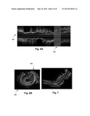 SYSTEMS AND METHODS FOR DETECTING AND DISPLAYING BODY LUMEN BIFURCATIONS diagram and image