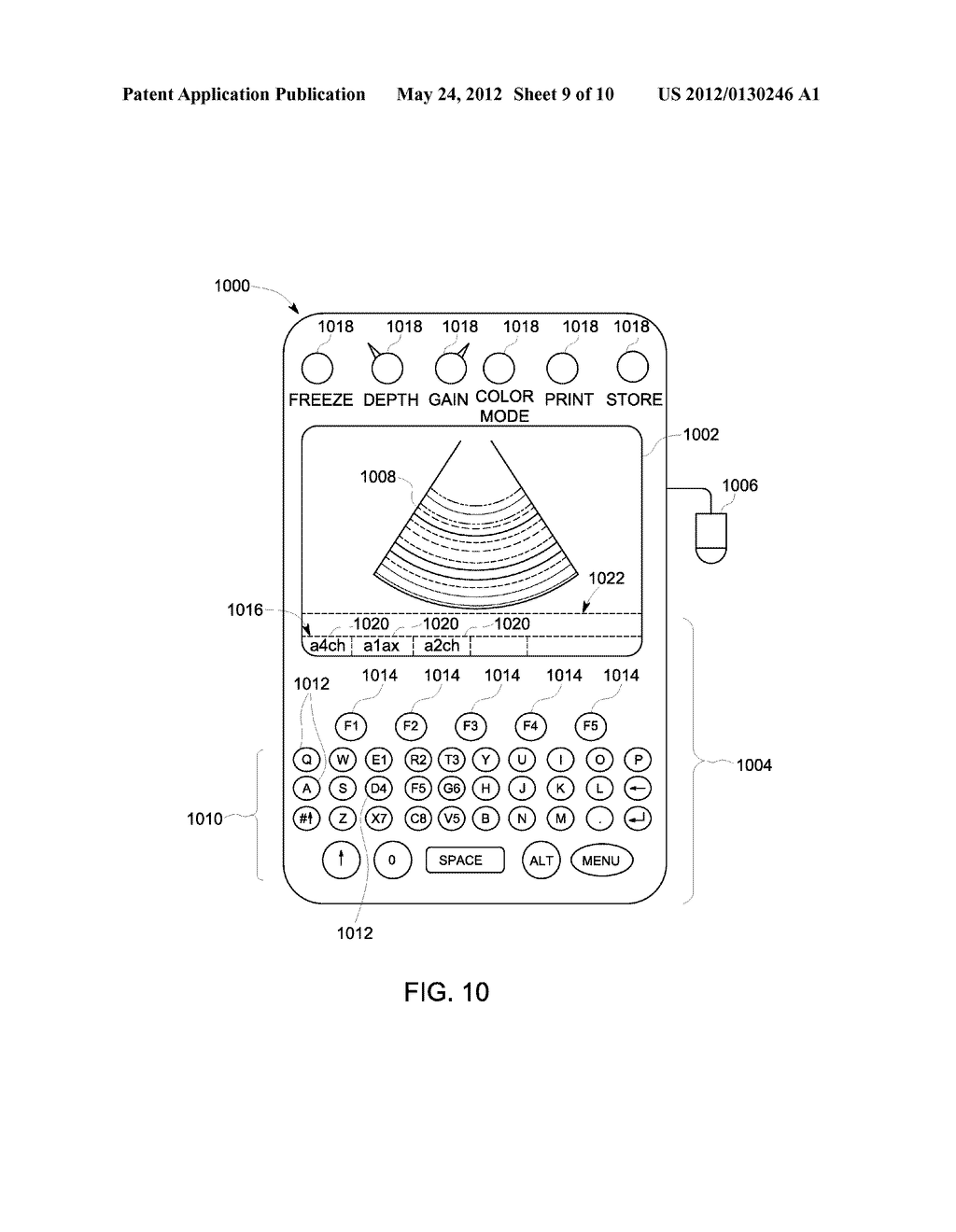 METHOD AND SYSTEM FOR CORRECTING ULTRASOUND DATA - diagram, schematic, and image 10