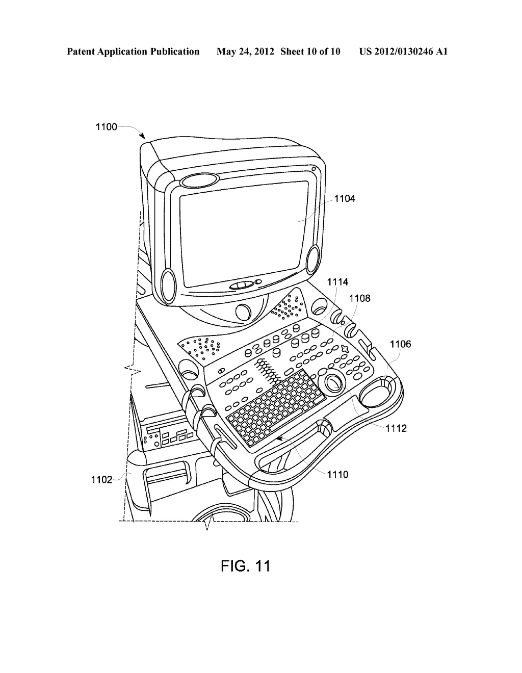 METHOD AND SYSTEM FOR CORRECTING ULTRASOUND DATA - diagram, schematic, and image 11