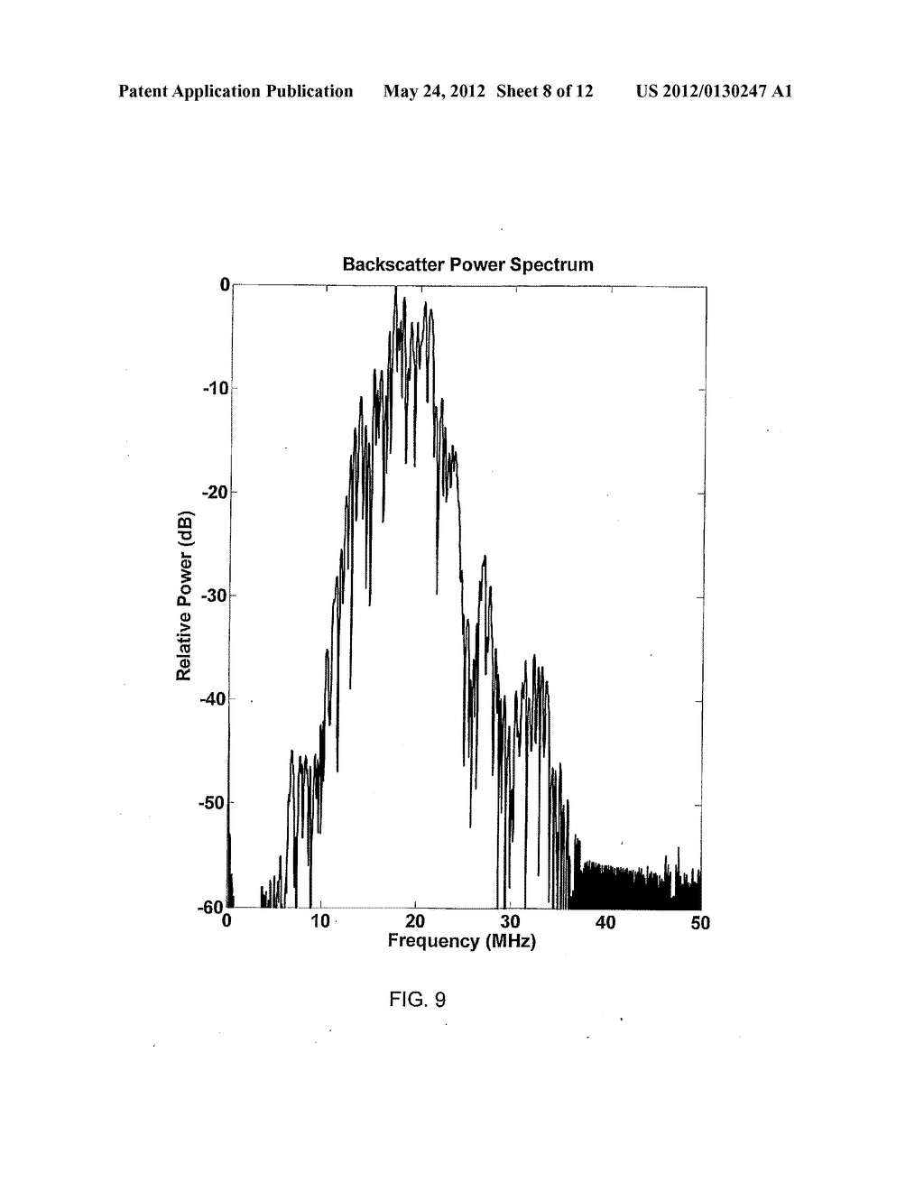 System and Method for Characterizing Tissue Based Upon Homomorphic     Deconvolution of Backscattered Ultrasound - diagram, schematic, and image 09