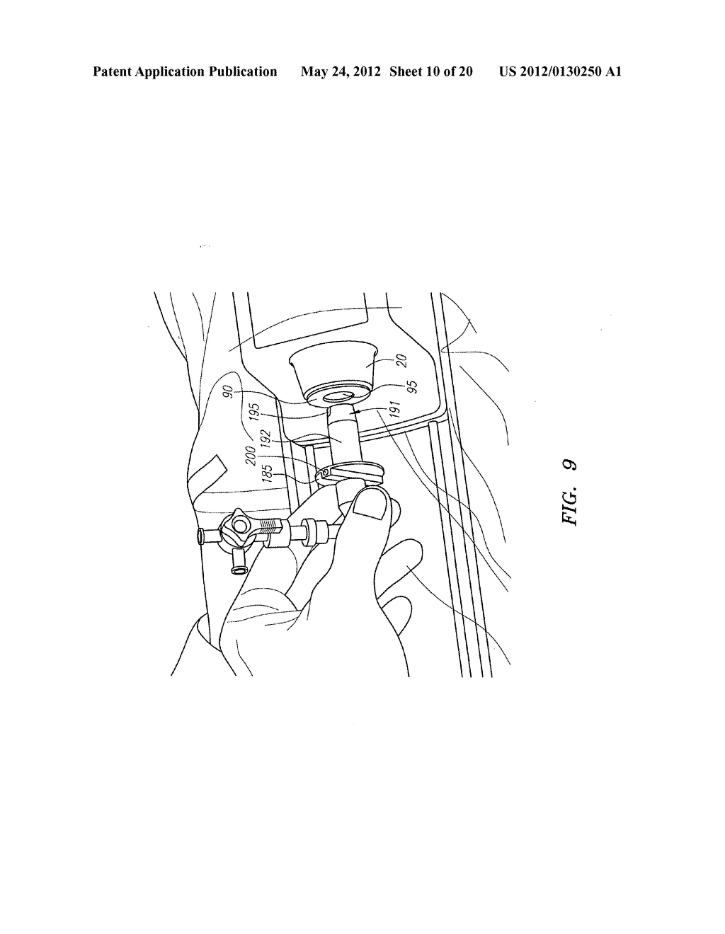 Pleated Bag for Interventional Pullback Systems - diagram, schematic, and image 11