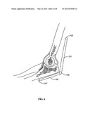 DEVICES, SYSTEMS, AND METHODS FOR MEASURING AND EVALUATING THE MOTION AND     FUNCTION OF JOINTS AND ASSOCIATED MUSCLES diagram and image