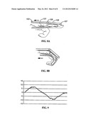 DEVICES, SYSTEMS, AND METHODS FOR MEASURING AND EVALUATING THE MOTION AND     FUNCTION OF JOINTS AND ASSOCIATED MUSCLES diagram and image
