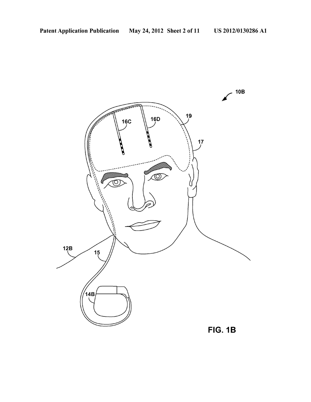 COLLECTING POSTURE INFORMATION TO EVALUATE THERAPY - diagram, schematic, and image 03