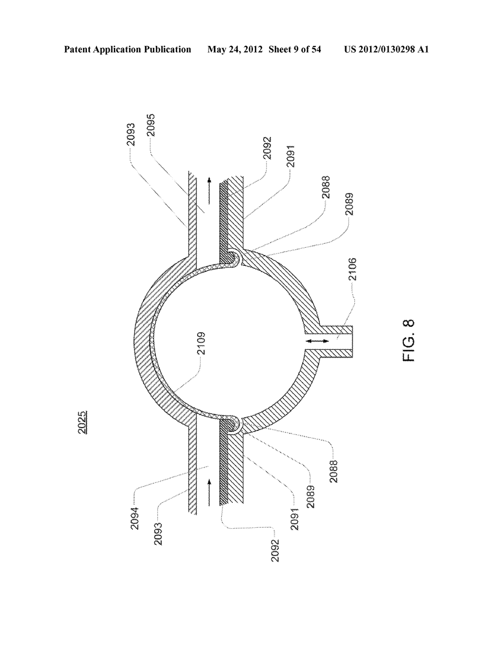 Systems, Devices and Methods for Cardiopulmonary Treatment and Procedures - diagram, schematic, and image 10