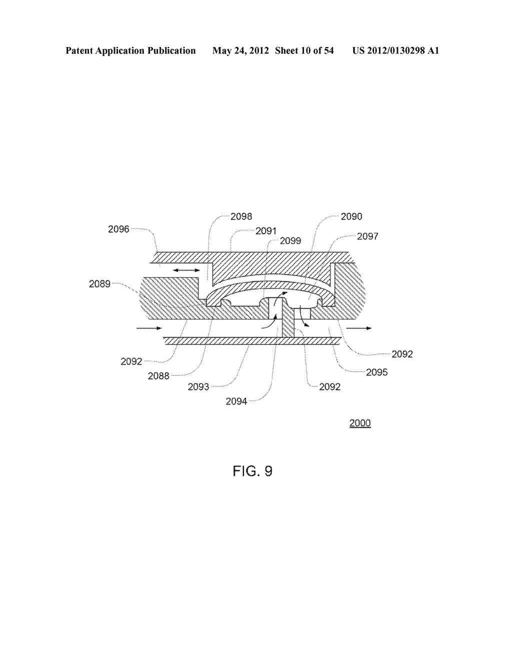 Systems, Devices and Methods for Cardiopulmonary Treatment and Procedures - diagram, schematic, and image 11