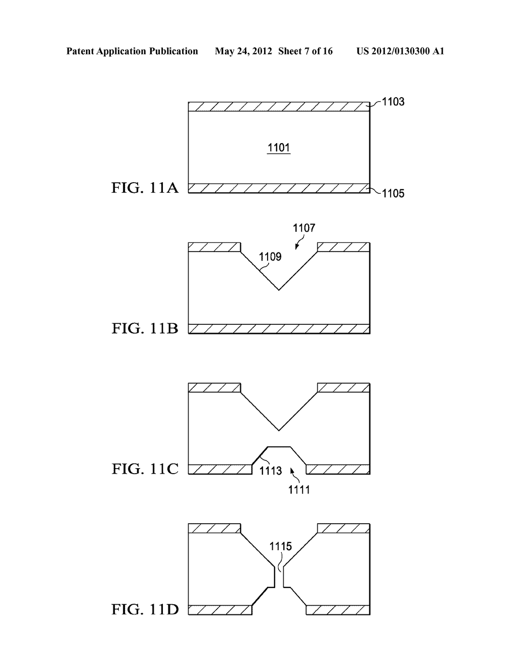 Therapeutic Methods Using Controlled Delivery Devices Having Zero Order     Kinetics - diagram, schematic, and image 08