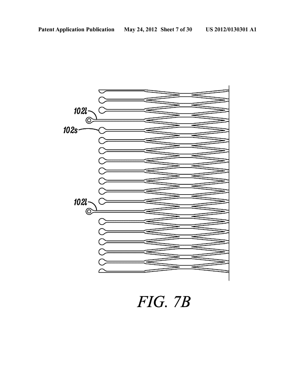 INTRA-ATRIAL IMPLANTS TO DIRECTIONALLY SHUNT BLOOD - diagram, schematic, and image 08