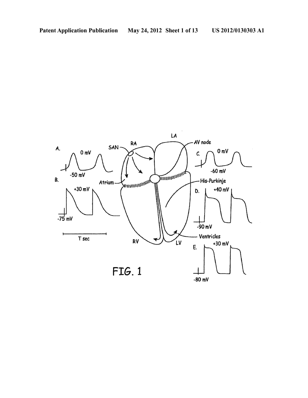 RATE CONTROL DURING AF USING CELLULAR INTERVENTION TO MODULATE AV NODE - diagram, schematic, and image 02