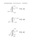 DEVICES, SYSTEMS, AND METHODS FOR MYOCARDIAL INFARCT BORDER ZONE     REINFORCEMENT diagram and image