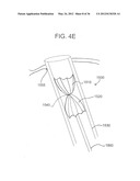 DEVICES, SYSTEMS, AND METHODS FOR MYOCARDIAL INFARCT BORDER ZONE     REINFORCEMENT diagram and image