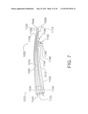 DEVICES, SYSTEMS, AND METHODS FOR MYOCARDIAL INFARCT BORDER ZONE     REINFORCEMENT diagram and image