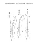 DEVICES, SYSTEMS, AND METHODS FOR MYOCARDIAL INFARCT BORDER ZONE     REINFORCEMENT diagram and image