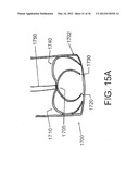 DEVICES, SYSTEMS, AND METHODS FOR MYOCARDIAL INFARCT BORDER ZONE     REINFORCEMENT diagram and image