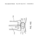 DEVICES, SYSTEMS, AND METHODS FOR MYOCARDIAL INFARCT BORDER ZONE     REINFORCEMENT diagram and image