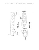 DEVICES, SYSTEMS, AND METHODS FOR MYOCARDIAL INFARCT BORDER ZONE     REINFORCEMENT diagram and image