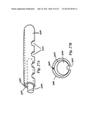 DEVICES, SYSTEMS, AND METHODS FOR MYOCARDIAL INFARCT BORDER ZONE     REINFORCEMENT diagram and image