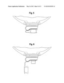 VALVE FOR OSTOMY POUCH diagram and image