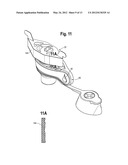 VALVE FOR OSTOMY POUCH diagram and image