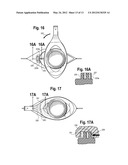 VALVE FOR OSTOMY POUCH diagram and image