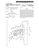 METHOD OF PERFORMING OSTEOTOMY diagram and image