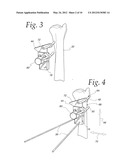 METHOD OF PERFORMING OSTEOTOMY diagram and image